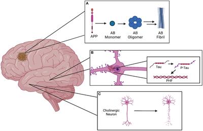 Alzheimer’s disease: a mini-review for the clinician